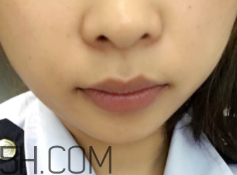 小蜜蜂細(xì)致修護(hù)唇膏很油嗎？夏天用合適嗎？