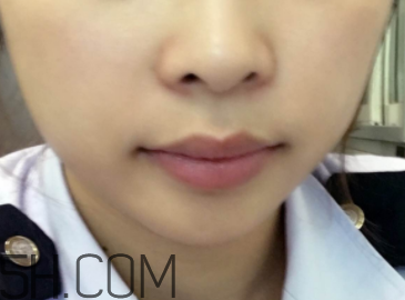 小蜜蜂細(xì)致修護(hù)唇膏很油嗎？夏天用合適嗎？