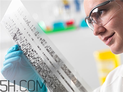 青光眼是什么?。壳喙庋凼窃趺吹玫?？