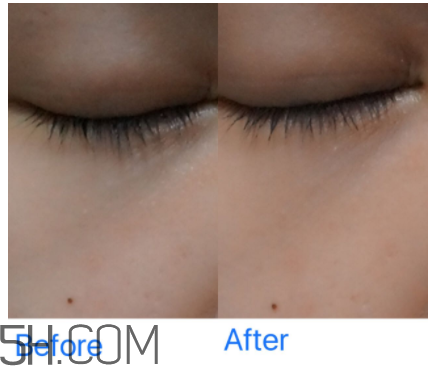 小蜜蜂水洗面膜怎么樣？小蜜蜂水洗面膜好用嗎？