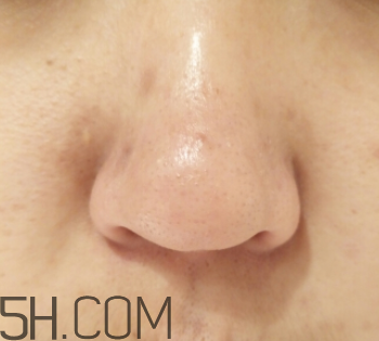 御泥坊鼻膜怎么樣？御泥坊鼻膜好用嗎？