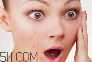 卸妝油適合痘痘肌膚嗎？植村秀卸妝油哪款最好用？