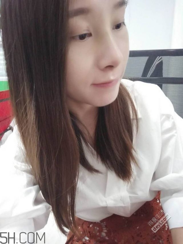 鼻頭縮小術(shù)過程圖 鼻頭縮小手術(shù)千萬別做后悔死 鼻頭縮小術(shù)過程圖 鼻頭縮小手術(shù)千萬別做后悔死