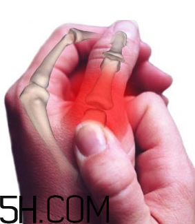 冬天關(guān)節(jié)痛怎么回事？關(guān)節(jié)痛怎么辦？