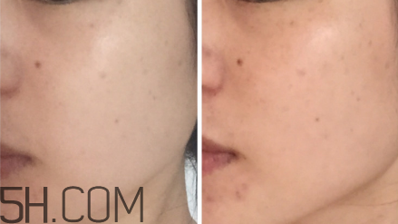 科顏氏淡斑精華液有用嗎？科顏氏淡斑精華液使用心得