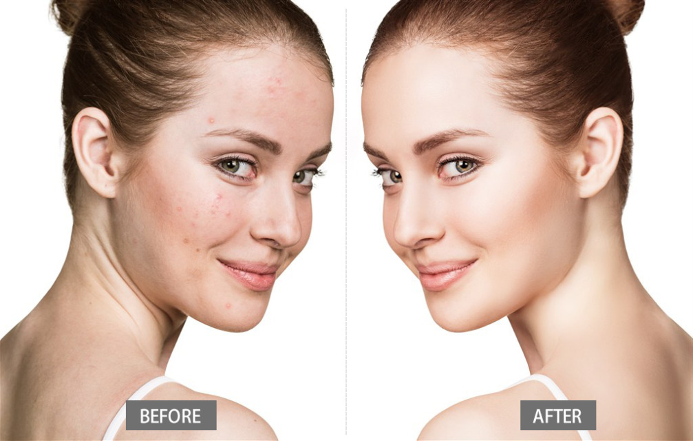 遮瑕怎么用具體步驟 完美遮瑕教程 遮瑕怎么用具體步驟 完美遮瑕教程