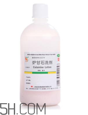 爐甘石洗劑是激素藥嗎？爐甘石洗劑是處方藥嗎？