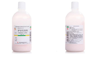 爐甘石洗劑是激素藥嗎？爐甘石洗劑是處方藥嗎？