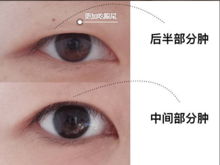 腫眼泡內(nèi)雙怎樣畫(huà)眼妝 內(nèi)雙腫眼泡拯救大法