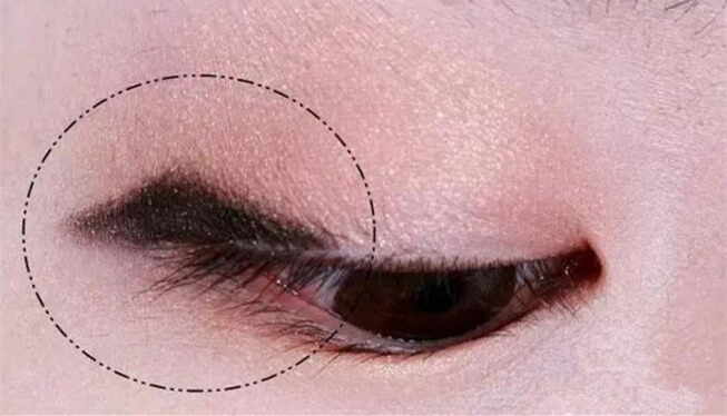 腫眼泡內(nèi)雙怎樣畫(huà)眼妝 內(nèi)雙腫眼泡拯救大法