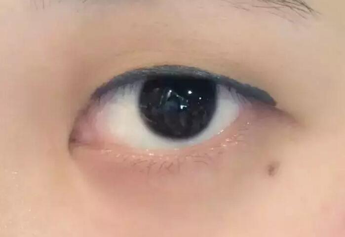 腫眼泡內(nèi)雙怎樣畫(huà)眼妝 內(nèi)雙腫眼泡拯救大法