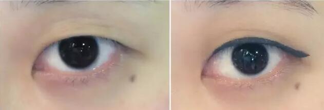 腫眼泡內(nèi)雙怎樣畫(huà)眼妝 內(nèi)雙腫眼泡拯救大法