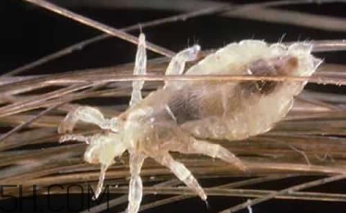 孩子長虱子是怎么回事？孩子長虱子該怎么辦？