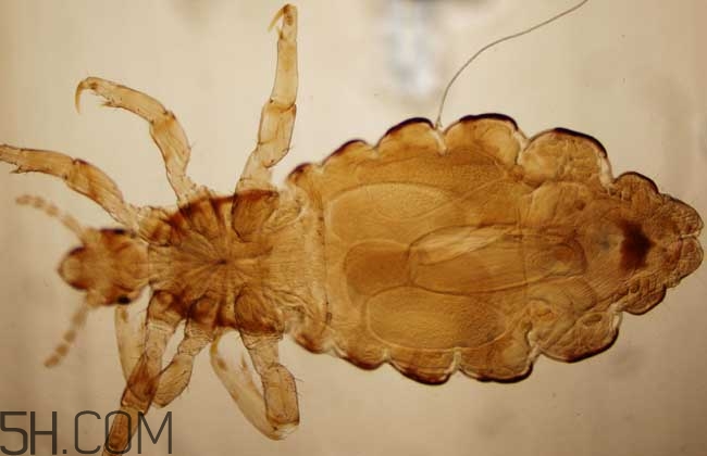 孩子長虱子是怎么回事？孩子長虱子該怎么辦？