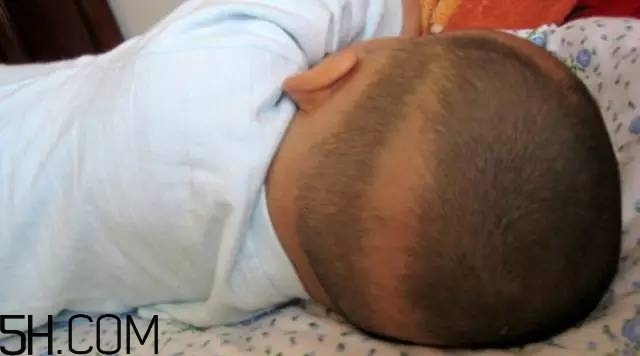 寶寶枕禿怎么辦？如何改善寶寶枕禿現(xiàn)象？