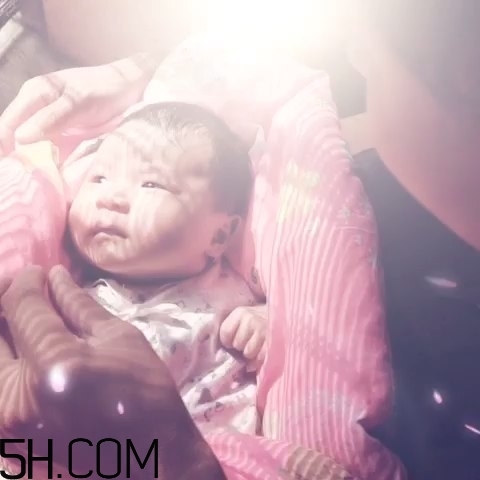 寶寶枕禿怎么辦？如何改善寶寶枕禿現(xiàn)象？