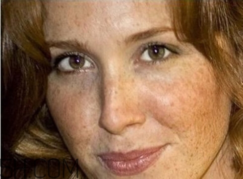 血瘀體質(zhì)容易長色斑嗎？有血瘀體質(zhì)的人如何去除色斑呢？