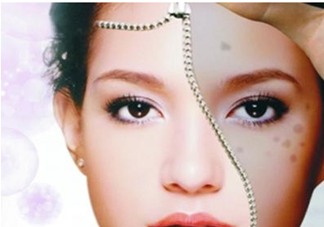 血瘀體質(zhì)容易長(zhǎng)色斑嗎？有血瘀體質(zhì)的人如何去除色斑呢？