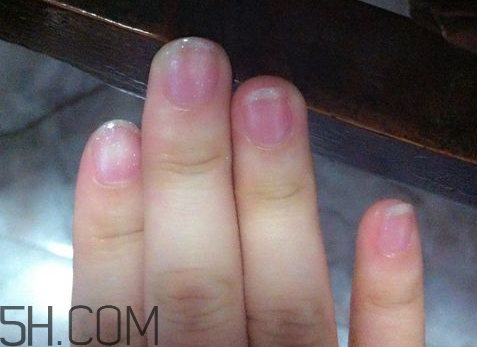 美甲后指甲受損怎么辦？指甲破損怎么修復(fù)？