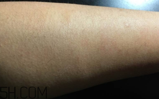 千纖草卸妝水有激素嗎？千纖草卸妝水曝光