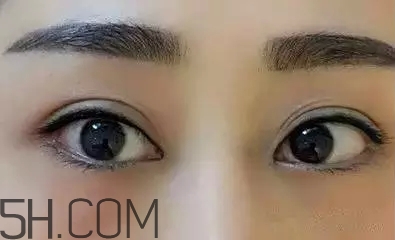 紋美瞳線是永久的嗎？紋美瞳線的注意事項