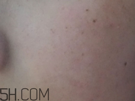 724高保濕面霜是什么？724高保濕面霜好用嗎？