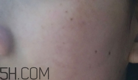 724高保濕面霜是什么？724高保濕面霜好用嗎？