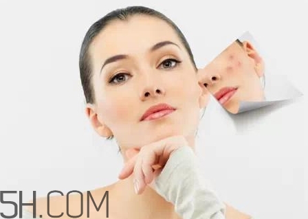 刷酸爆痘正常嗎？為什么刷酸會(huì)爆痘？