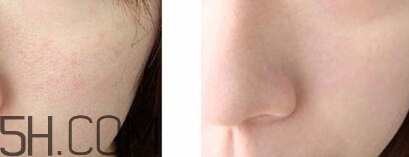 豬油膏要卸妝嗎？豬油膏怎么卸妝？