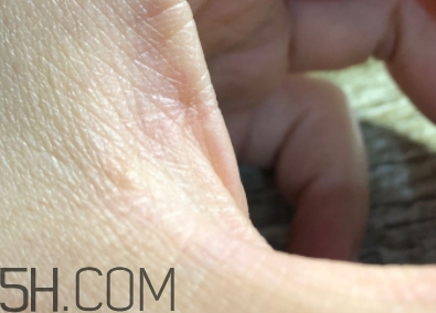 雅頓金膠適合什么膚質(zhì)？雅頓金膠適合油皮和混油皮嗎？