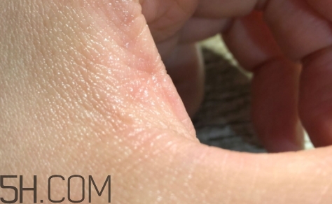 雅頓金膠適合什么膚質(zhì)？雅頓金膠適合油皮和混油皮嗎？