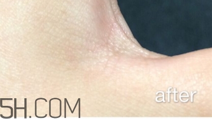 雅頓小銀蛋是什么？雅頓小銀蛋多少錢？