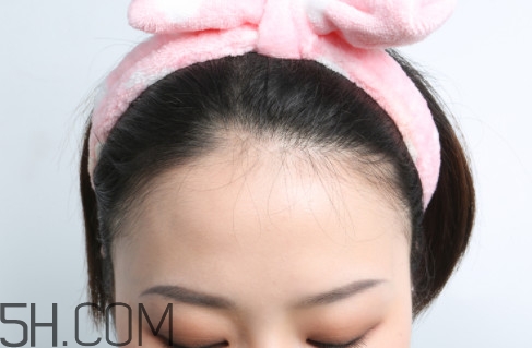 發(fā)際線不好看怎么修飾 完美解決6種發(fā)際線問題 發(fā)際線不好看怎么修飾 完美解決6種發(fā)際線問題