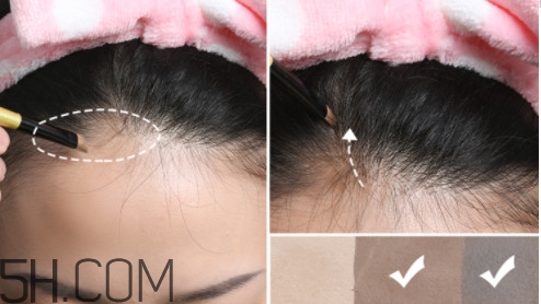 發(fā)際線不好看怎么修飾 完美解決6種發(fā)際線問題 發(fā)際線不好看怎么修飾 完美解決6種發(fā)際線問題