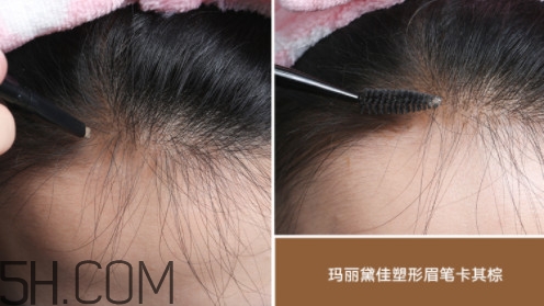 發(fā)際線不好看怎么修飾 完美解決6種發(fā)際線問題 發(fā)際線不好看怎么修飾 完美解決6種發(fā)際線問題