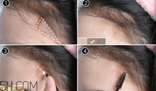 發(fā)際線不好看怎么修飾 完美解決6種發(fā)際線問題 發(fā)際線不好看怎么修飾 完美解決6種發(fā)際線問題