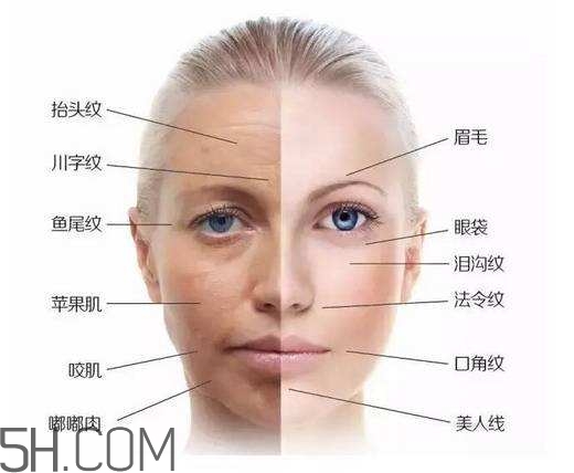 怎么預(yù)防皺紋的產(chǎn)生？導(dǎo)致皺紋的產(chǎn)生的原因有哪些？