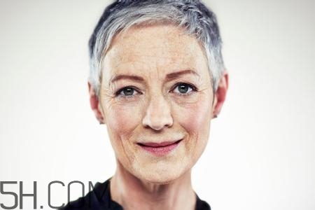 怎么預(yù)防皺紋的產(chǎn)生？導(dǎo)致皺紋的產(chǎn)生的原因有哪些？