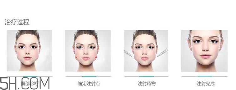 打瘦臉針可以抽煙嗎？打瘦臉針會(huì)反彈嗎？