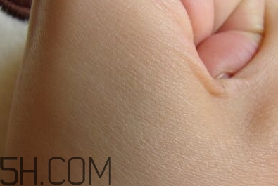 雅頓眼膠怎么用？雅頓眼膠使用方法