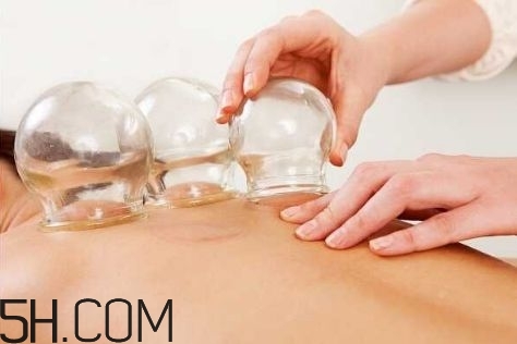 拔罐可以治療鼻炎嗎？鼻炎拔罐拔哪里？