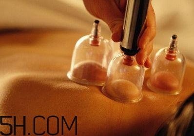 拔罐可以治療鼻炎嗎？鼻炎拔罐拔哪里？