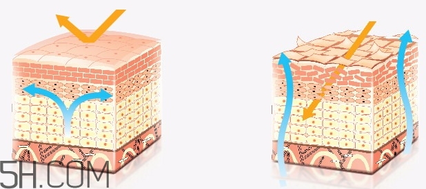 水楊酸可以去雞皮膚嗎？水楊酸治療雞皮膚方法