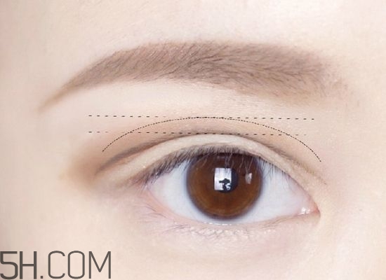 割完雙眼皮不能吃什么？割完雙眼皮如何進(jìn)行飲食調(diào)理？