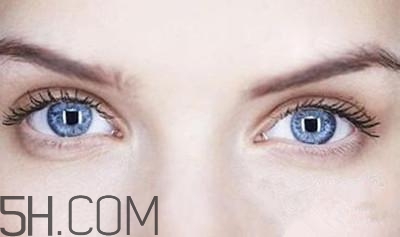 割完雙眼皮不能吃什么？割完雙眼皮如何進(jìn)行飲食調(diào)理？