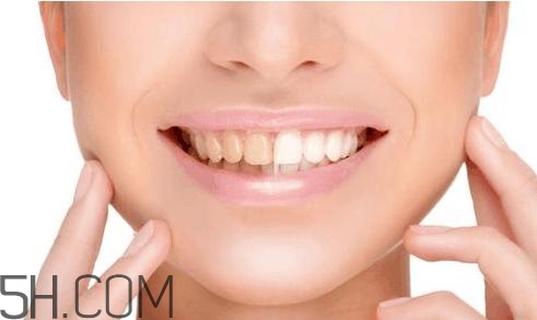 羨慕別人的大白牙？為什么你的牙齒這么黃？