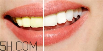 羨慕別人的大白牙？為什么你的牙齒這么黃？
