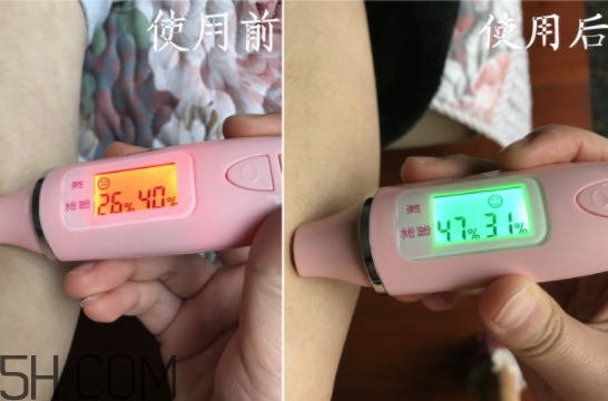 水楊酸可以去黑頭嗎？水楊酸可以去閉口嗎