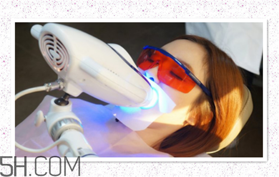 超聲波洗牙可以美白牙齒嗎？超聲波洗牙多少錢一次？