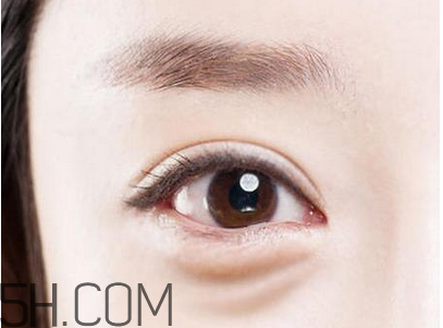 超聲法去眼袋效果好不好？超聲刀可以去除眼袋嗎？